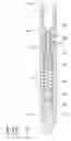 Fig. 03 - Well downhole liquid dispenser
