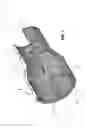 Fig. 07 - Expandable tubulars for use in geologic structures, methods for expanding tubulars, and methods of manufacturing expandable tubulars