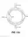 Fig. 23 - Waste water treatment process