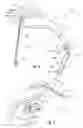 Fig. 04 - Carrying device for a cartable item providing single to dual-shoulder support transitioning
