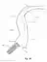 Fig. 09 - Carrying device for a cartable item providing single to dual-shoulder support transitioning