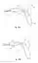 Fig. 16 - Carrying device for a cartable item providing single to dual-shoulder support transitioning