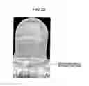 Fig. 23 - Welding method