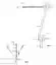 Fig. 06 - Surgical instrument support device and method