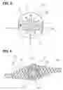 Fig. 04 - Laser welding method, laser welding structure, and throttle valve device