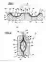 Fig. 02 - Automotive trim component having an elastomeric skin with a foam core and method for making same