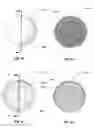 Fig. 20 - Method for making a sintered superhard prosthetic joint component