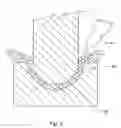 Fig. 22 - Method for making a sintered superhard prosthetic joint component