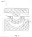 Fig. 26 - Method for making a sintered superhard prosthetic joint component
