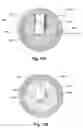 Fig. 28 - Method for making a sintered superhard prosthetic joint component