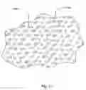 Fig. 34 - Method for making a sintered superhard prosthetic joint component