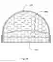 Fig. 45 - Method for making a sintered superhard prosthetic joint component