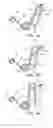 Fig. 10 - Feeding mechanism