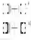 Fig. 04 - MRI system utilizing supplemental static field-shaping coils