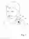 Fig. 02 - Enuresis device with magnetic fastener