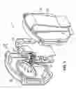 Fig. 02 - System and method for detecting motion of a body