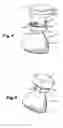 Fig. 05 - Fastening system for fixing a light source on a counterpart of a motor vehicle headlight, and a method of applying it