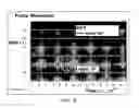 Fig. 07 - System and method for transmitting control information over an AC power network
