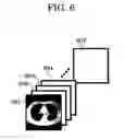 Fig. 07 - Radiography apparatus and radiation image processing method
