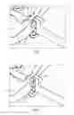 Fig. 03 - Housing for a hearing aid or hearing device respectively