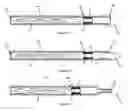 Fig. 10 - Sliding piston opening means