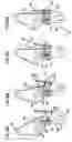 Fig. 07 - Loader assembly, combination motor vehicle and loader assembly, hydraulic cylinders and methods for operating a loader assembly