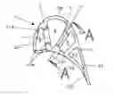 Fig. 01 - Turbine blade with impingement cooling