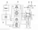 Fig. 01 - External counter pulsation apparatus