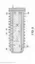 Fig. 06 - Local intraosseous administration of bone forming agents and anti-resorptive agents, and devices therefor
