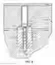 Fig. 07 - Local intraosseous administration of bone forming agents and anti-resorptive agents, and devices therefor