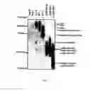 Fig. 04 - Pseudotyped viruses and methods for their use