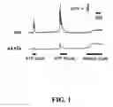 Fig. 02 - Methods of treating restenosis