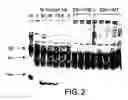 Fig. 03 - Methods of treating sickle cell disease