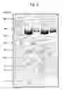 Fig. 04 - Anthrax antigenic compositions