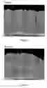 Fig. 03 - Thermal barrier coating