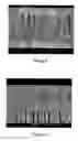 Fig. 06 - Thermal barrier coating