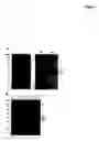 Fig. 02 - Compositions and methods for diagnosing and preventing severe acute respiratory syndrome (SARS)