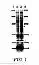 Fig. 02 - Polypeptides implicated in the expression of resistance to glycopeptides, in particular in Gram-positive bacteria, nucleotide sequence coding for these polypeptides and use for diagnosis