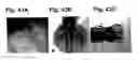 Fig. 44 - Fibroblast growth factor receptors and methods for their use