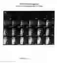 Fig. 10 - Method and apparatus for high density format screening for bioactive molecules