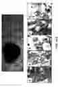 Fig. 02 - Diagnostic and prognostic methods for prostate cancers
