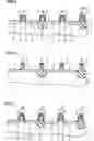 Fig. 07 - Method of manufacturing semiconductor device