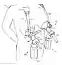 Fig. 01 - Hands-free breast milk expression system