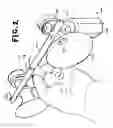 Fig. 03 - Hands-free breast milk expression system