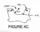 Fig. 09 - CMP polishing heads retaining ring groove design for microscratch reduction