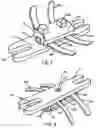 Fig. 02 - Universal croquet wicket lighting unit
