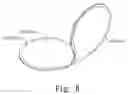 Fig. 09 - Seaming structure for use in baseballs and softballs