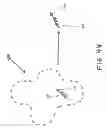 Fig. 45 - Method and composition for treating cancer by converting soluble radioactive toxic agents into insoluble radioactive toxic precipitates via the action of non-mammalian enzymes bound to the non-endocytosing receptors of target cells