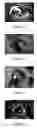 Fig. 02 - Composition and method for the treatment of eye disease