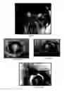 Fig. 05 - Composition and method for the treatment of eye disease